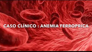 Caso Clínico Bioquímica  Anemia ferropriva [upl. by Aihsa]