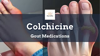 colchicine  Uses Dosage Side Effects amp Mechanism  Colcrys [upl. by Eenahc]