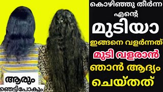 ഒരിക്കലും വളരില്ല 😱എന്ന് പറഞ്ഞ എന്റെ മുടി ഞാൻ വളർത്തി എടുത്തത് ഇങ്ങനെ How to grow hair [upl. by Khajeh418]