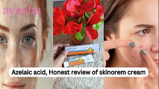 How to Use Azelaic Acid 20 benefits of azelaic acid Skinoren Cream Review in Pakistan [upl. by Iru595]