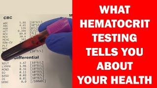 What Hematocrit Tells You About Your Health Hematology [upl. by Ynneh]