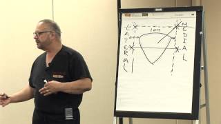 6 Intra Articulate Injection Points of the Knee by Dr Ernest Roman  Empire Medical Training [upl. by Der]