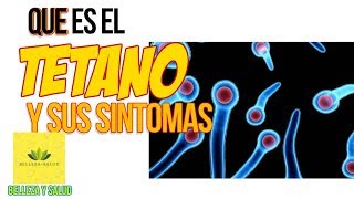 Que Es El Tetano y Cuales Son Sus Sintomas [upl. by Norud]