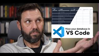 Access your database right inside vscode [upl. by Solberg]