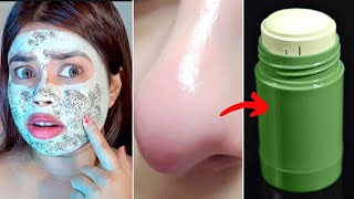 I am SHOCK  😱 tried Viral Green mask stick  Does This Green Mask work [upl. by Quincey]