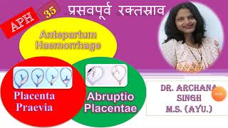 35 APH ANTEPARTUM HAEMORRHAGE  प्रसवपूर्व रक्तस्राव [upl. by Adnuahsor]