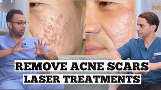 Erase Your Acne Scarring  How To Remove Acne Scars With LASERS  Dr Somji amp Dr Solomon discuss [upl. by Aekin221]