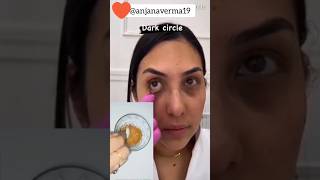 😍Remove dark circles eye wrinkles in ju 3 days DIY home remedy try ampget beautiful eyesytshorts [upl. by Ransome]