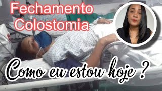 REVERSÃO DE COLOSTOMIA COMO EU ESTOU HOJE [upl. by Isabella]