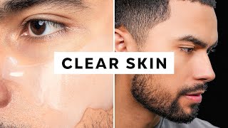 How To Get Clear Skin Only 3 Steps [upl. by Ydne258]