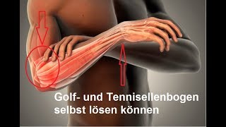 schnelle Selbsthilfe bei Golferarm amp Tennisellenbogen  Epicondylitis [upl. by Eirehs321]