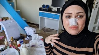 تجميل الانف بدون جراحه 😰اول مره اعمل كدا في نفسي [upl. by Anikehs]