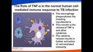 Management of Tuberculosis in Patients on TNF alpha Inhibitors [upl. by Jonny]