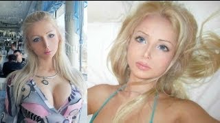 Real life Barbie 21yearold Ukrainian Valeria Lukyanova undergoes surgery [upl. by Llewen]