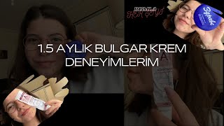 BULGAR KREMİ KULLANIM SÜRECİM Achromin ve Zdrave kremleri  𝗥𝘂𝗺𝗹𝗮 𝗛𝗲𝗿 𝗦̧𝗲𝘆𝗶 [upl. by Inaj67]