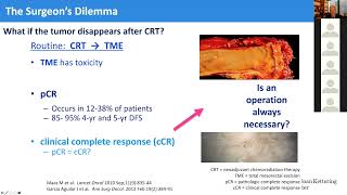 DocTalk Dr Josh Smith on Nonoperative Management in Rectal Cancer [upl. by Faust]