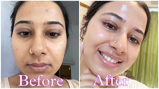 Dermatologist recommended Best 2 Cream under Rs 300 that has changed my skin  Best pharmacy cream [upl. by Tare]