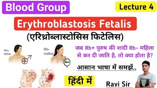 Erythroblastosis Fetalis In Hindi  Haemolytic Disease  Science Guru Ravi [upl. by Levy510]