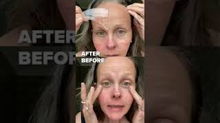 Anti Wrinkle Face Patches to Reduce Fine Wrinkles Reusable [upl. by Swane]