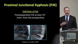 Proximal Junctional Kyphosis and Failure by Darrel S Brodke MD [upl. by Netsirc]