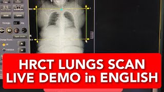 HRCT Chest  Live demo in English on Toshiba 16 Slice [upl. by Nylitsirk258]