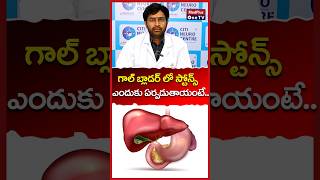 Gallstones Causes  All you need to know l Dr Nagarjuna shorts MEDplusedplusOneTV [upl. by Ferna]