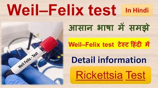 Weil–Felix test  Test for Rickettsia  Detail information in Hindi [upl. by Dahsra]