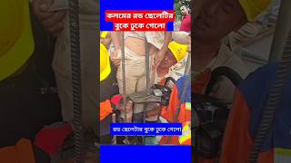 কলমের রড ছেলেটির বুকে ঢুকে গেলোconcrete construction working plan work shorts viral trending [upl. by Einnal]