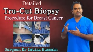 Tru Cut Biopsy Procedure for Breast Cancer  Surgeon Dr Imtiaz Hussain [upl. by Mikael622]