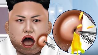 ASMR Facial care for Kim JongUn  Skincare Animation  Removal Ingrown Hair Sebum Shaving [upl. by Bradshaw]