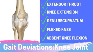 Gait Deviations Knee Joint Complex Secondary to Knee Joint Dysfunction [upl. by Zennie317]