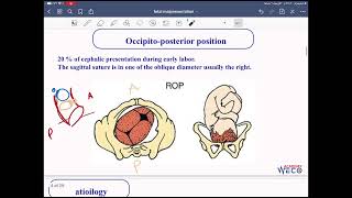 Obstetrics Fetal malpresentation 1 [upl. by Ijok427]