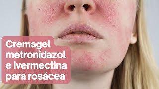 Cremagel con metronidazol e ivermectina para el tratamiento de la rosácea [upl. by Ancel254]