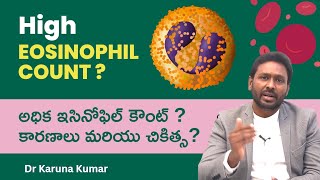 Reasons for High Eosinophil Counts  How to Reduce Eosinophils  Dr Karuna Kumar Hematologist [upl. by Isaak]