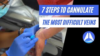 7 steps to cannulate the most difficult veins Live demonstration [upl. by Oberg]