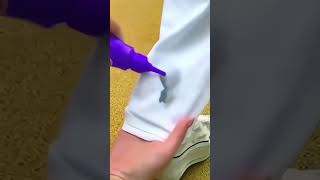 Instant Stain Remover shorts gadgets [upl. by Okorih]