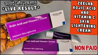 Zeelab Kojic Acid Vitamin C Cream  Kojic acid and vitamin c cream  Honest Review sale review [upl. by Ridglee]