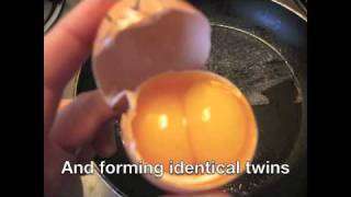 How Identical Twins are Made honors genetics project 2 [upl. by Gass]