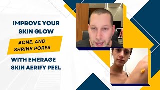 IMPROVE YOUR SKIN GLOW ACNE AND SHRINK PORES WITH EMERAGE SKIN AERIFY PEEL  DR JASON EMER [upl. by Fae]