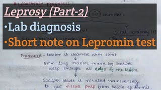 Leprosy Part2  Lab diagnosis of leprosy  Lepromin test short note  mformicrobiology108 [upl. by Emile43]