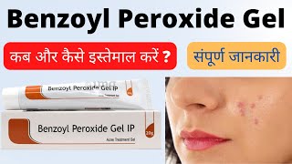 Things I wish I knew before usingpurchasing BENZOYL PEROXIDE BENZAC AC  South African YouTuber [upl. by Rodenhouse615]