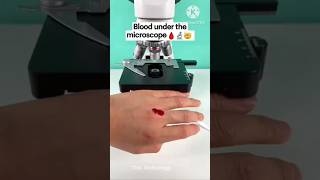 Blood Under The Microscope microscope thistechnology facts shoets funny shortsfeed viral [upl. by Gehman708]