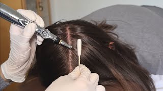 ASMR Perfectionist SCALP Exam with Sensory Tests Analysis and TREATMENT Real Person [upl. by Atiuqet]