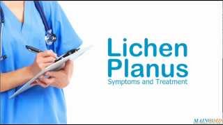 Lichen Planus Symptoms and Treatment [upl. by Coltson91]