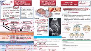 10 COMPLICACIONES LEUCOMALACIA PERIVENTR PARALISIS CEREBRAL INFANTIL [upl. by Crissy]