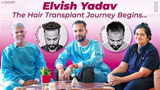 Unlocking Celebrity Hair Transplant Secrets Elvish Yadavs Eugenix Experience [upl. by Maleen]