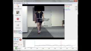 Gait Analysis Frontal with Simi Aktisys [upl. by Salvadore]