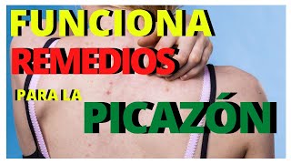 COMO QUITAR la PICAZON en el CUERPO en MINUTOS con ALGO NATURAL REMEDIOS CASEROS para LA COMEZÓN [upl. by Isador]