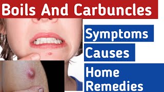 Boils and Carbuncles What causes boils on your body Boils on body home treatment [upl. by Newmark536]