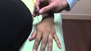 How To Manipulate an Acupuncture Needle  Oriental Medicine with Dr Justin Newman [upl. by Lamont104]